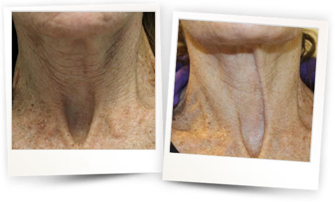 Joely Kaufman, MD, USA