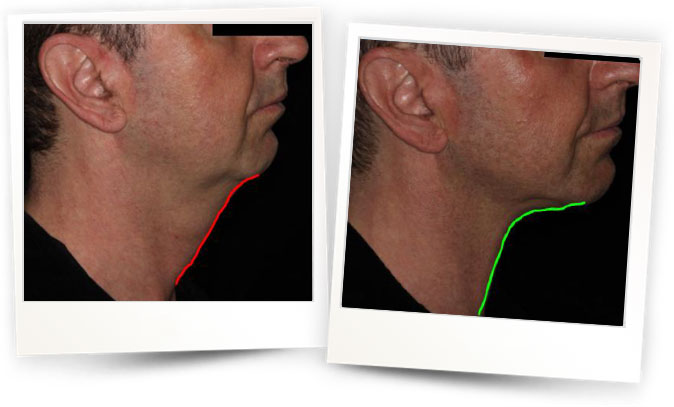 Matteo Tretti Clementoni, MD, İtalya